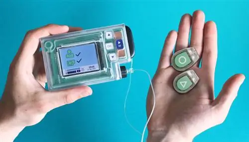 искусственная поджелудочная железа