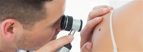 Лучшая выживаемость для людей с метастатическим раком кожи