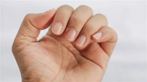Ребристые ногти? Это возможные причины