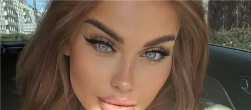 Знаменитость о последствиях турецких операций. «Я не мог ходить, есть и даже испражняться»