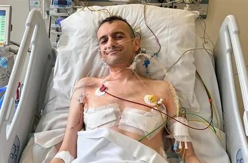 Яцеку пересадили легкие, это вторая такая пересадка в мире. «Всего 125 человек живут с этим заболеванием»