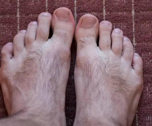 У тебя ноги хоббита? Проверьте, не могут ли волосы на пальцах ног и верхней части стоп предвещать болезнь