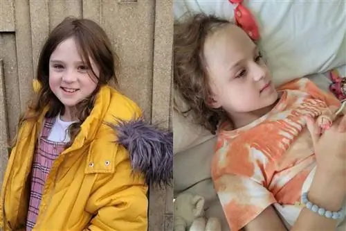 Все началось с головных болей. Исследования показали, что у 9-летнего ребенка редкий дефект