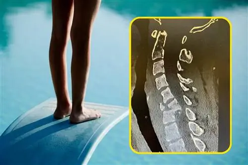 " 23 года, жертва вечеринки" . Врач показал снимок сломанного позвоночника и обратился к окружающим