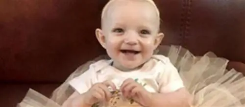 Эта девочка родилась с более чем сотней опухолей. Ей не дали шанса выжить