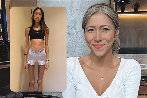 Она была одержима своим весом. Доктор хочет помочь другим с похожими проблемами