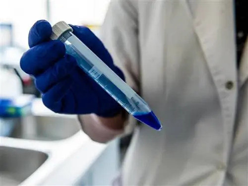 Можно ли заразиться коронавирусом дважды? Эксперты все еще проводят исследования