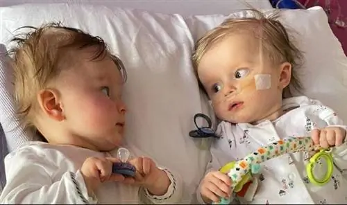 Врачи сказали, что дети ленивы. Близнецы борются за жизнь и здоровье