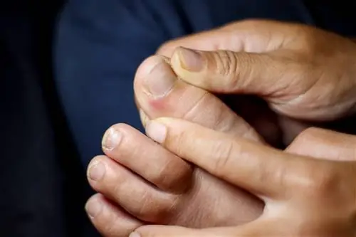 Дефицит этого витамина может вызвать неврологические проблемы. Ваши ногти скажут вам, если вы пропустите это