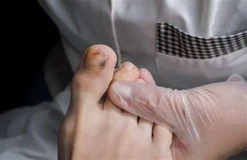 Похоже на синяк, может быть рак. Появляется на ногтях