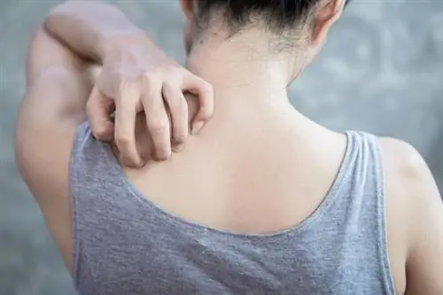 Женщина чешет шею