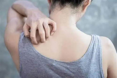 Чувствуете непрекращающийся зуд? Стресс может быть причиной