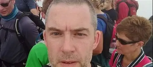 Он думал, что головные боли были результатом похмелья. Анализы показали, что у него неоперабельная глиобластома