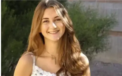 Этот 15-летний подросток страдает от необычной аллергии. «Я не могу плакать или мыться»