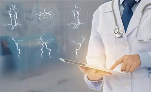 Артериальный круг головного мозга - виллизиев круг - строение, роль и заболевания