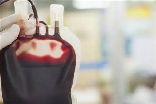 Гемодилюция: что это такое? Преимущества и риски процедуры
