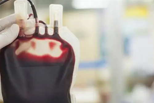 Гемодилюция: что это такое? Преимущества и риски процедуры