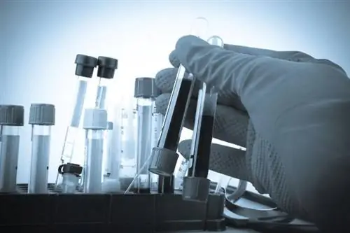 Карциноэмбриональный антиген (СЕА, карциноэмбриональный антиген) - в норме