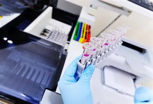 Проточная цитометрия: показания и курс