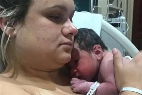 " Вы даже не знаете, что ребенок болен." 12-дневный ребенок умер от «поцелуя смерти»