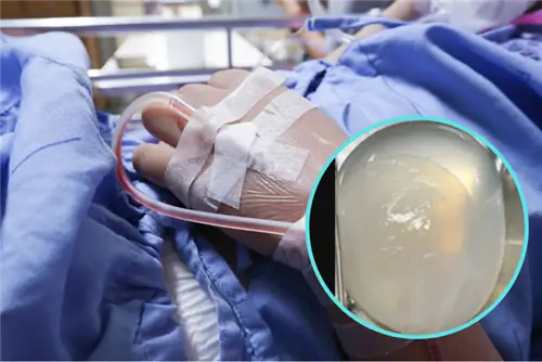 Они вырезали его из мозга 14-летнего подростка. Ленточный червь был виноват