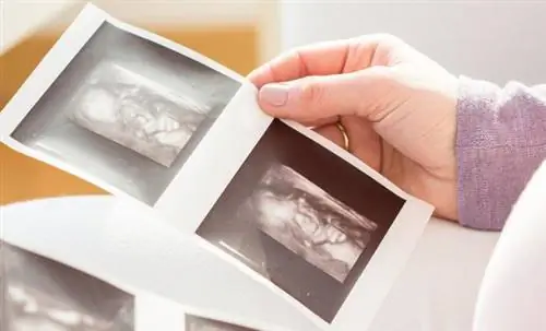 Шок во время УЗИ. Они не могли поверить, что внутри черепа плода