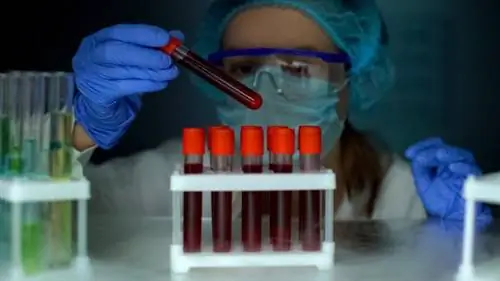 Пациент из Дюссельдорфа излечился от ВИЧ. Однако метод опасен