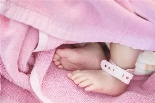 Девочка родилась с 6-сантиметровым хвостом. Врачи показали фотографии