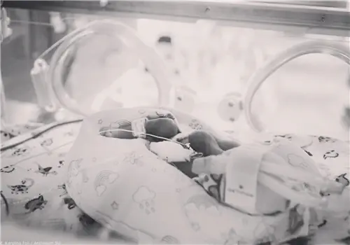 Одна из пятерняшек, родившихся в Кракове, умерла. Ему было 3 дня. «Мы опустошены»