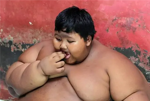 В 11 лет он весил почти 200 кг. Сегодня его не узнать