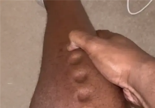 Ноги спортсмена «превратились в пластилин». Причиной стала тяжелая болезнь