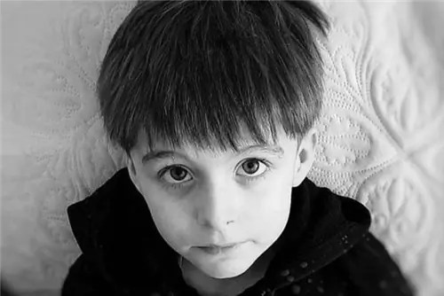 Вся Польша поддержала его в борьбе с болезнью. 10-летний Джонни умер