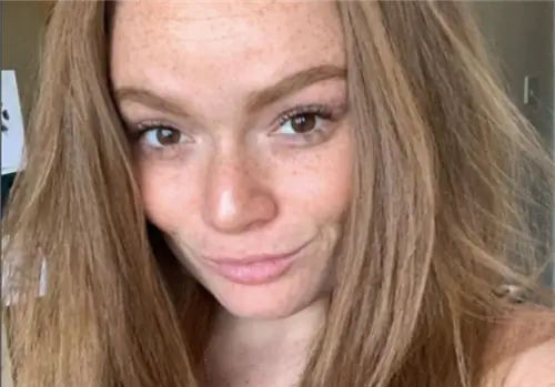 Люди думают, что она все еще пьяна. Побочные эффекты болезни «разрушили ее жизнь»