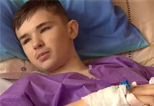 Они позвонили после дежурства, чтобы спасти руку 13-летнего подростка. Удивительный жест хирургов в Тшебнице