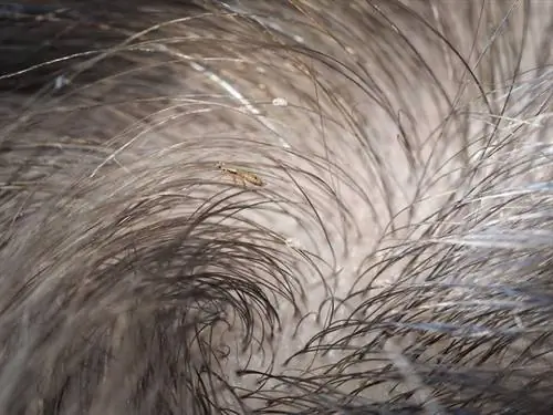 Симптомы головных вшей