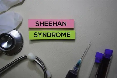 Синдром Шихана - причины, симптомы, лечение