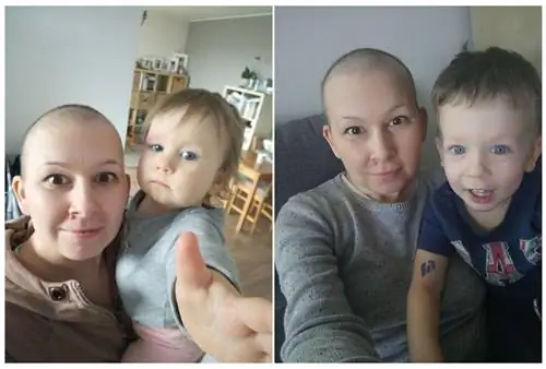 У меня был рак молочной железы HER2+. Сегодня я здоров
