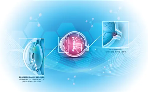 Яркость для контроля