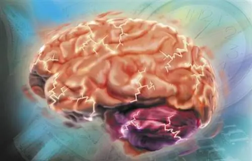 Мозг компьютерного игрока устроен иначе. Как компьютерные игры влияют на мозг?