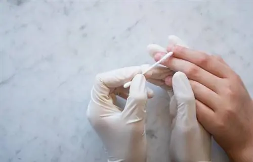 Нанесение лекарства от бородавок на ладонь