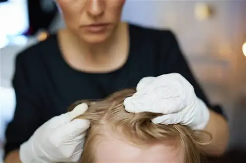 Человеческие вши - в волосах, лобке, одежде