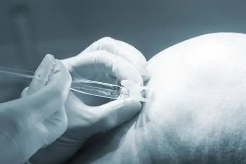 Пункция коленного сустава: показания и курс