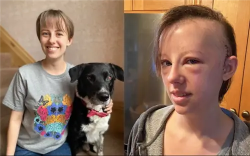 22-летний мужчина умирает. Она заранее организовала Рождество. Меня не победить рак