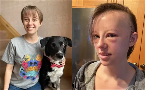 22-летняя девушка умерла, потому что организовала Рождество в ноябре. «Меня не победить»