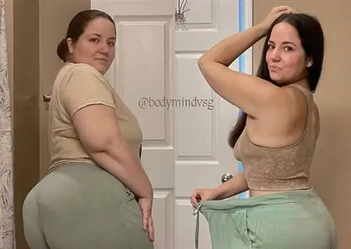 25-летний мужчина похудел более чем на 60 килограммов благодаря бариатрической операции.