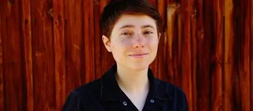 Кости этого человека почернели. Это редкий побочный эффект лекарств