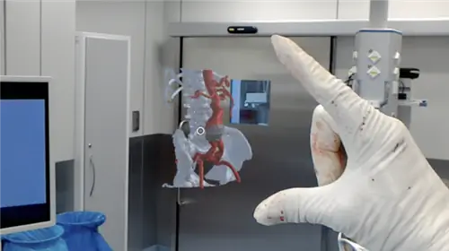 Первая в мире операция на брюшной аорте с использованием голограммы