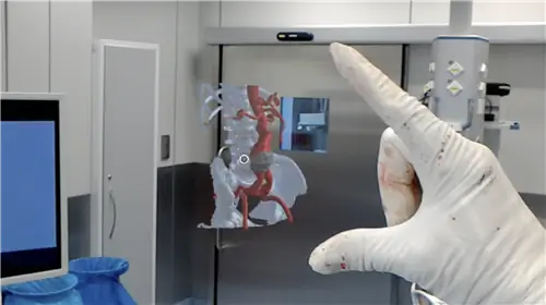 Первая в мире голографическая операция на брюшной аорте