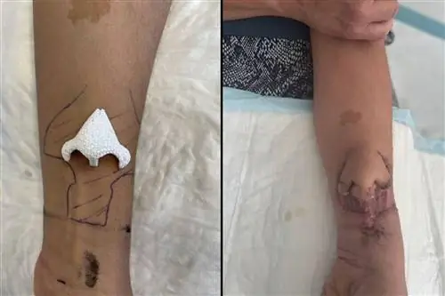 Рак уничтожил ее нос, врачи вырастили новый - на предплечье. "Я снова жив"