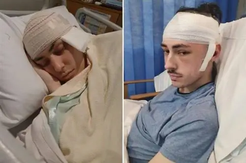 У него была опухоль головного мозга размером с грейпфрут. 23-летний мужчина более года борется с раком.